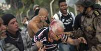 <p>Homem ferido durante protesto em Belo Horizonte, na primeira Fase da Copa das Confederações</p>  Foto: AP