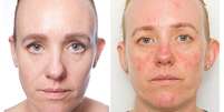 <p>Repórter fica um mês sem tirar a maquiagem e percebe efeitos negativos na pele</p>  Foto: Reprodução