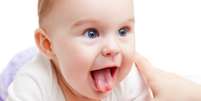 Bebês que mordem o bico do seio da mãe ao mamar, não conseguem colocar a língua para fora ou, quando colocam, ela está arredondada ou bifurcada. Esses são alguns sinais de que o recém-nascido pode ter a língua presa, que nada mais é do que o encurtamento do freio da língua  Foto: Shutterstock