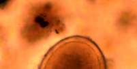 Ovos de lombriga foram encontrados no solo do local onde estava o corpo do rei Ricardo 3º  Foto: Piers Mitchell/Department of Archaeology and Anthropology/University of Cambridge / Divulgação