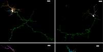 Imagem mostra no topo à esquerda um neurônio normal. À direita deste, está um neurônio de um camundongo com mutação no gene que produz a proteína NHE6. Na parte inferior, à esquerda, aparece novamente um neurônio normal e, à direita, um com defeito - mas ambos tendo recebido tratamento com BDNF  Foto: Morrow lab/Brown University / Divulgação