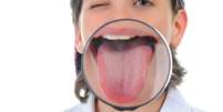 A l&iacute;ngua &eacute; uma grande fonte de informa&ccedil;&otilde;es sobre a sa&uacute;de de cada um e, por isso, examinar os aspectos dela (colora&ccedil;&atilde;o, textura e odor) pode ser determinante para o diagn&oacute;stico de patologias  Foto: Shutterstock