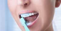 Uma boa escovação dental não acontece em menos de dois minutos  Foto: Shutterstock