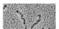 A proteína TNC, em imagem microscópica  Foto: Harold Erickson / Divulgação