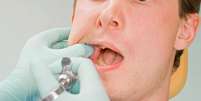 Normalmente, as pessoas torcem o nariz quando vão ao dentista. Mas será que a sensação da consulta é realmente desagradável ou existe uma boa dose de preconceito? Existem procedimentos desconfortáveis realizados no consultório do dentista, mas não são todos, nem a maioria.  Foto: Shutterstock