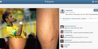 <p>Neymar mostra machucado em rede social após ser caçado em campo</p>  Foto: Reprodução