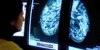 Entidades que combatem câncer de mama não recomendam uso de estatina e pedem mais estudos  Foto: BBC News Brasil