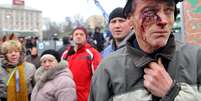 Manifestante ferido por policiais participa de protesto na praça da Independência, em Kiev, contra a violência repressão policial  Foto: AFP