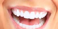 Quem disse que só a roupa deve ser branca no Ano-Novo? Os dentes também merecem atenção e podem fazer o sorrio brilhar na hora de pular as sete ondinhas  Foto: Shutterstock