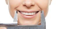 O sorriso perfeito deve ter pelo menos metade da largura da face. O lado direito e esquerdo dos lábios devem ser simétricos e igualmente carnudos  Foto: Shutterstock