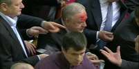 Um deputado ficou com o nariz sangrando depois de levar um soco no rosto de outro parlamentar  Foto: BBC News Brasil