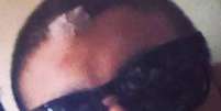 <p>Caio Castro aparece em foto de fã com ferimento no rosto</p>  Foto: BangShowBiz / BangShowBiz