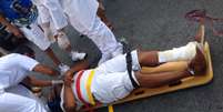 <p>Cambista teve a perna quebrada durante agressão</p>  Foto: Diego Garcia / Terra