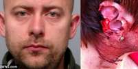 Damian Chwedczuk maltratava a mulher há 3 anos e foi preso após morder e arrancar orelha de esposa  Foto: Reprodução