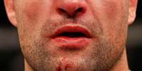 Nariz de Shogun ficou fora do lugar ap&oacute;s o soco de Henderson  Foto: Getty Images 