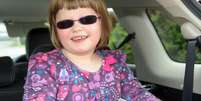 Millie Hough, 7 anos, foi diagnosticada com Síndrome de Alstrom, uma doença rara que afeta um em cada um milhão de nascidos  Foto: Daily Mail / Reprodução