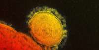 <p>Ainda de acordo com McDonald, o v&iacute;rus corona recebe este nome por possuir superf&iacute;cie rugosa, cheia de picos, semelhante a uma coroa, explica o porta-voz do CDC americano</p>  Foto: AP