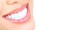 Hoje, existem muitas opções de tratamentos estéticos para os dentes e gengivas, capazes de deixar o sorriso harmonioso sem grandes esforços  Foto: Shutterstock