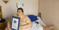 <p>Manuel Uribe Garza tinha obesidade mórbida desde os 10 anos</p>  Foto: Twitter
