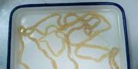 <p>O verme instalado no intestino da chinesa Li tinha 2 metros de comprimento</p>  Foto: Twitter