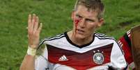 Schweinsteiger disputa bola pelo alto e leva bra&ccedil;ada de Ag&uuml;ero no rosto. Ele sai sangrando de campo e &eacute; atendido pelos m&eacute;dicos  Foto: Paulo Whitaker / Reuters