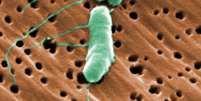 <p>Bactéria vibrio vulnificus pode comer a carne humana, a partir do momento de infecta uma pessoa</p>  Foto: Wikimedia