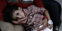 Criança ferida por ataque na cidade síria de Douma  Foto: ABD DOUMANY / AFP