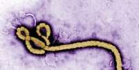 <p>Morfologia ultraestrutural do vírus ebola em foto colorida</p>  Foto: Frederick Murphy / Reuters