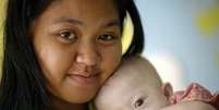 Gammy, hoje com 7 meses, foi considerado por especialistas livre de problemas cardíacos  Foto: Damir Sagolj / Reuters