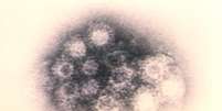 V&iacute;rus visto pelo microsc&oacute;pio (imagem revelada pelo CDC)  Foto: Live Science / Reprodu&ccedil;&atilde;o