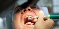 <p>Mark van Nierop &eacute; suspeito de abuso e fraude por sua atividade de dentista</p>  Foto: Thinkstock