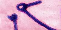 <p>Part&iacute;culas do v&iacute;rus Ebola em imagem de microsc&oacute;pio divulgada por laborat&oacute;rio das For&ccedil;as Armadas dos EUA</p>  Foto: USAMRIID / Reuters