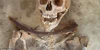 Esqueletos tinham foice em torno do pesco&ccedil;o para evitar que corpos "voltassem" como "vampiros"  Foto: Daily Mail / Reprodu&ccedil;&atilde;o