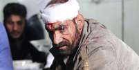 Homem ferido é atendido em um hospital de campanha após ataques aéreos em Damasco. 8/12/2014.  Foto: Badra Mamet / Reuters
