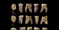 Dentes possuem características híbridas e geram possibilidade de nova espécie   Foto: IFL Science/Centro Nacional de Investigación sobre la Evolución Humana / Reprodução