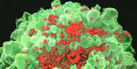 O vírus da Aids em imagem de microscópio: nova pílula sugere esperança para tratamento  Foto: The Independent / Reprodução