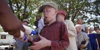 <p>A ONU denunciou um aumento desde 2013 de ataques contra albinos na Tanzânia</p>  Foto: Katrina Manson / Reuters