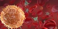 Cientistas descobriram que é possível forçar as células da leucemia a amadurecer em um tipo de célula imunológica, que, ironicamente, pode ajudar o corpo a combater outras células tumorais  Foto: IFL Science / Reprodução