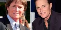 <p>Bruce Jenner est&aacute; mudando de sexo</p>  Foto: Getty Images 