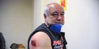 Manifestante é ferido durante repressão a protesto de professores em Curitiba  Foto: Everson Bressan / SMCS