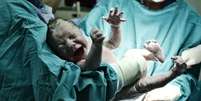 Brasil está em 77º lugar no ranking com 179 países sobre bem-estar materno   Foto: BBC News Brasil