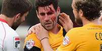 Michael Timlin sofreu corte profundo em partida neste domingo  Foto: Jamie McDonald / Getty Images