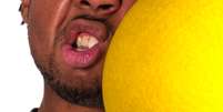Uma bolada no rosto pode levar à perda dos dentes definitiva. Neste caso, só o implante pode resolver  Foto: istock / Getty Images