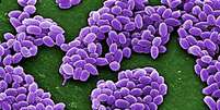 Esporos da variedade Sterne da bactéria antraz (Bacillus anthracis) são retratados nesta imagem de divulgação de microscópio eletrônico de varredura (MEV) obtida pela Reuters  Foto: CDC / Reuters
