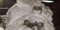 Temendo que seu apêndice estourasse antes de poder sair da Antártida, Rogozov decidiu fazer uma cirurgia em si mesmo  Foto: BBC / Reprodução