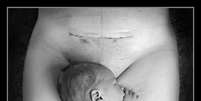 Fotografia de recém-nascido ao lado de cicatriz de cesária causa polêmica na internet  Foto: Helen Carmina Photography / Facebook/Reprodução