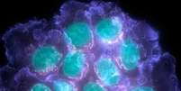 Ao se detectar a recidiva antes, tratamentos como quimioterapia podem ser feitos mais cedo, aumentando a chance de sobrevida do paciente  Foto: Divulga&ccedil;&atilde;o/BBC Brasil