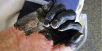 Peste bubônica, a forma mais comum da doença, afeta os nódulos linfáticos e causa gangrena  Foto: Divulgação/BBC Brasil