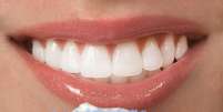 As pastas de dente clareadoras diminuem os tons mantendo a cor original dos dentes  Foto: Brian Chase / Shutterstock