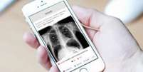 Aplicativo criado por médico canadense permite que médicos compartilhem e discutam casos   Foto: Reprodução